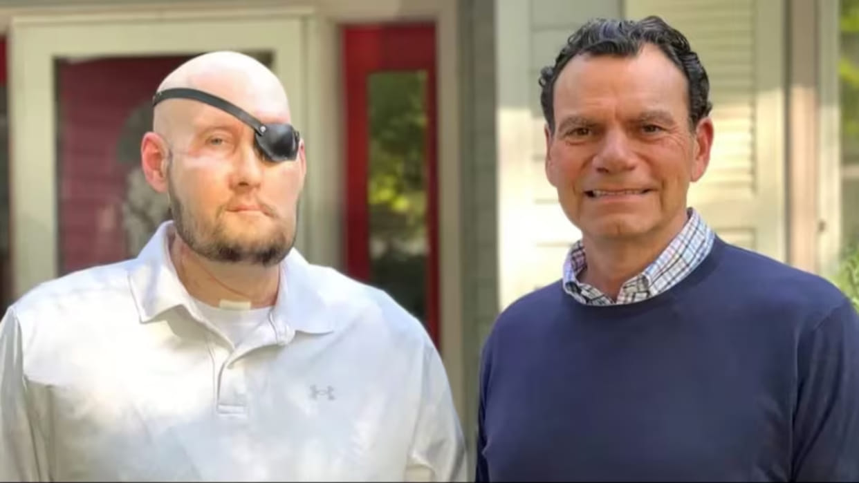 USA World first total eye transplant portion of donor face and entire left eye transplanted to recipient