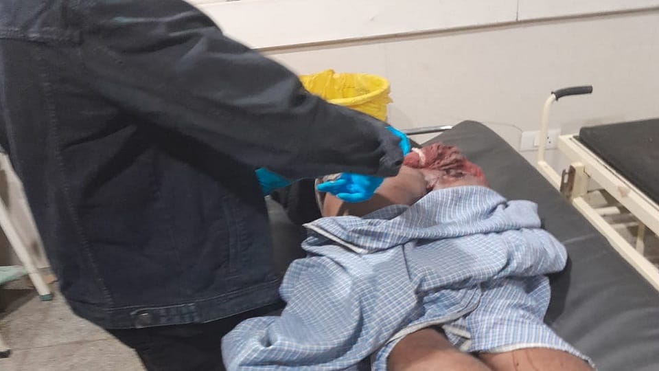 young man injured after being hit by firecracker in Noida