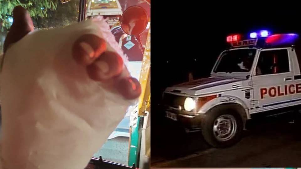 Car driver bites bike rider finger with his teeth and separates him in delhi
