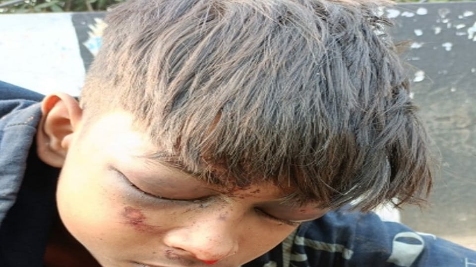 Teenager found unconscious in Hathras