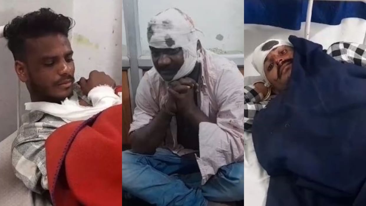 Chhindwara News Due to election rivalry in Chandameta swords clashed between three people many injured