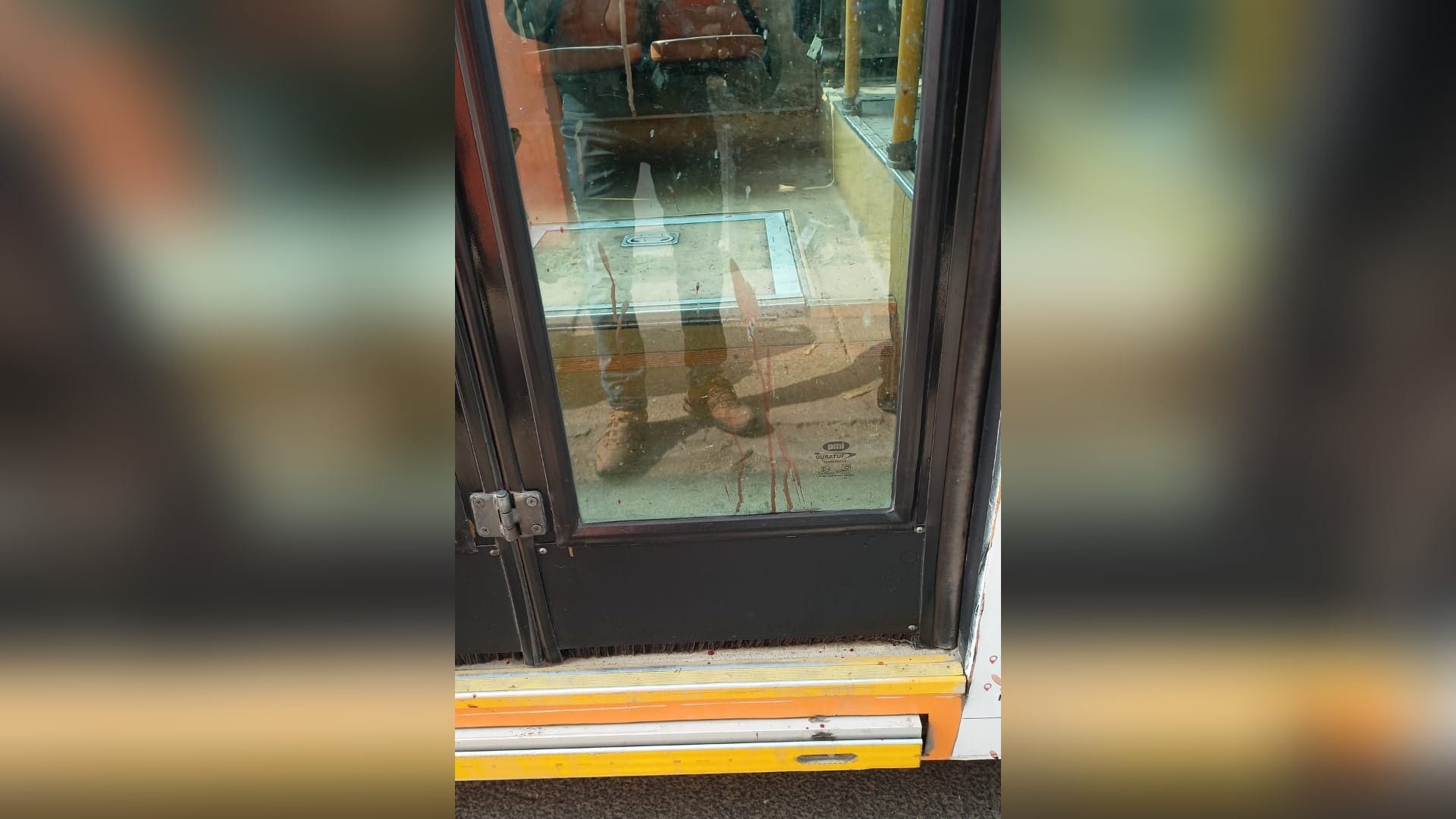 Engineering student attacks bus conductor with chapapad, condition critical due to neck injury