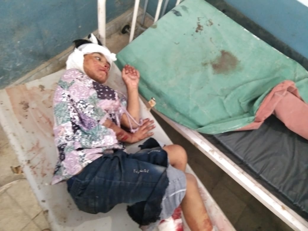 Girl cut off both legs after falling while boarding train, was coming home with mother from Godan Express