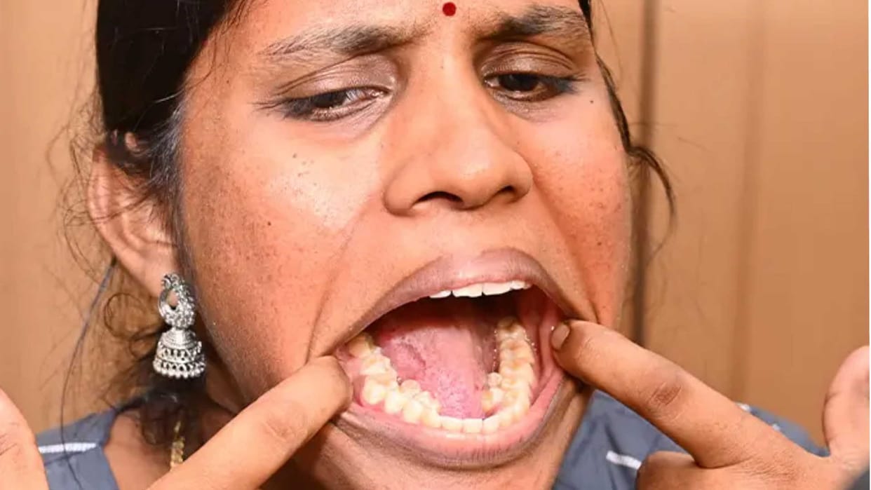Guinness World Record for indian woman with 38 teeth know details in hindi