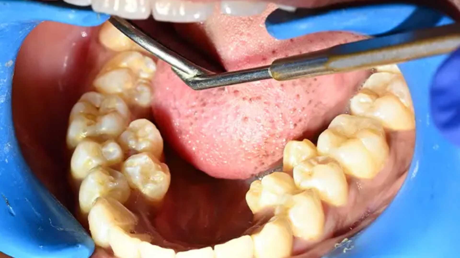 Guinness World Record for indian woman with 38 teeth know details in hindi