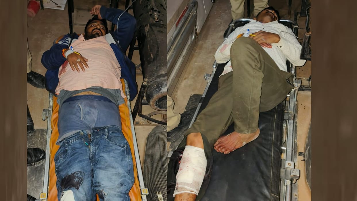 Two goons injured in police encounter in salon kotwali in raebareli.