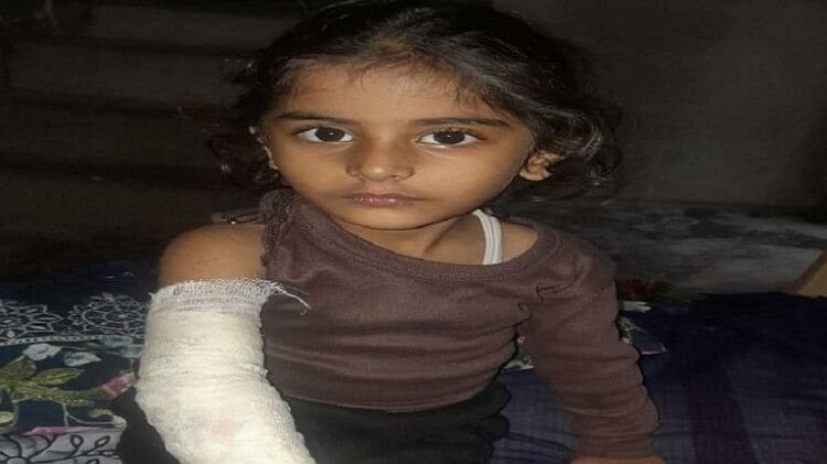 Hathras News: खेलते समय फिसला पैर, बाल्टी में रखे गर्म पानी पर गिरी मासूम, बच्ची झुलसी