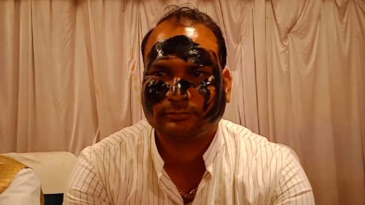MP Election: Before Baraiya, Congress leader blackened his face, said this to Bhander MLA