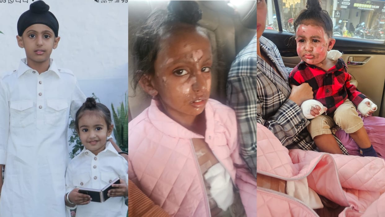 Haryana: Two children injured due to fire in popcorn machine