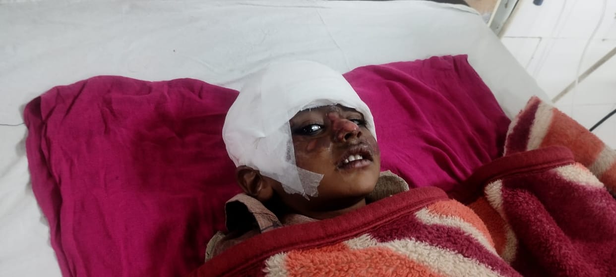 Car driver hits innocent child in Etawah, then hits car and drags him for 50 meters, incident captured in CCTV