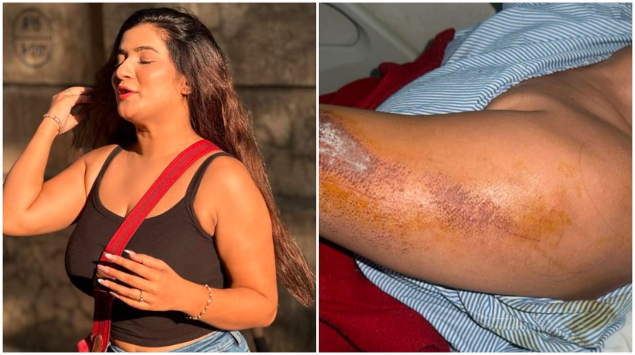 Social media user slammed Priya for accusing her boyfriend of trying to run her over with a car
