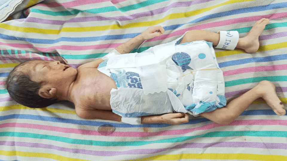 A newborn died during Ijaal in Korba
