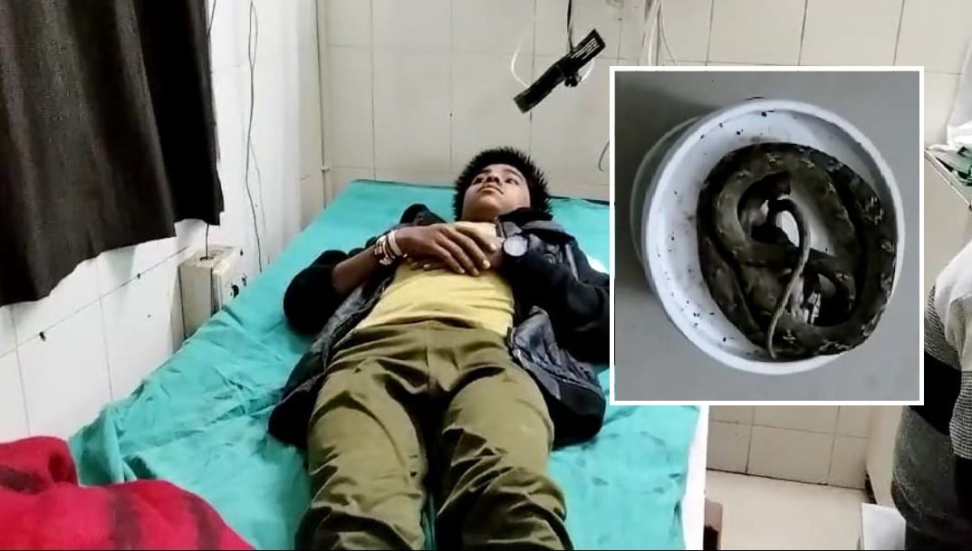 The family reached the hospital with the son along with the snake, he got bitten while watering the field