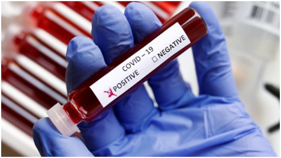 Coronavirus New Variant JN.1 Karnataka Govt Symptomatic Close Contacts Covid-19 Test