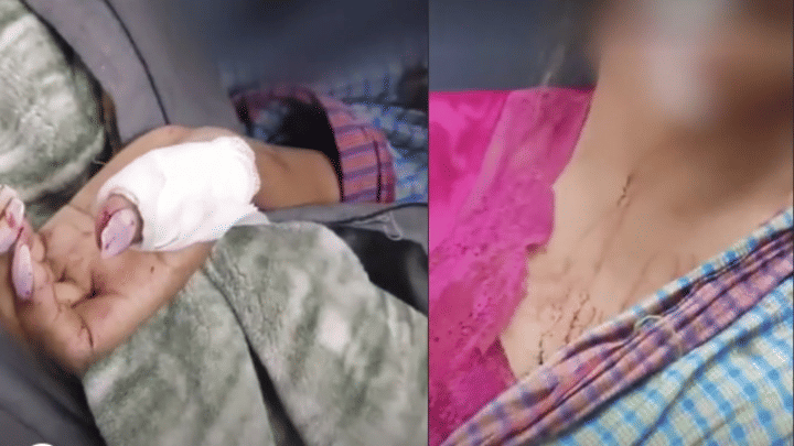 The miscreant attacked and injured kinnar