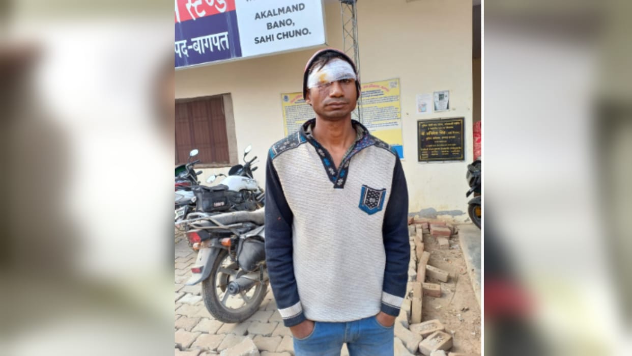 Baghpat: Wife stabs husband with scissors in his eyes when he asks for tea, gets injured,
