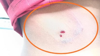 Bullying stand staff in medical college fierce beating and abuse of young man in Korba