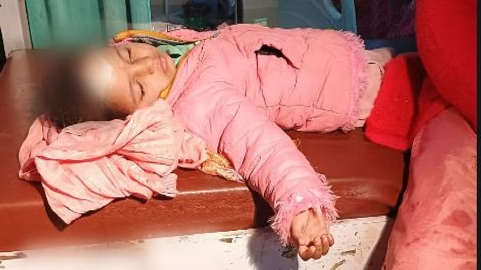 Four-year-old girl fell while taking photo at Taj on New Year suffered head injury