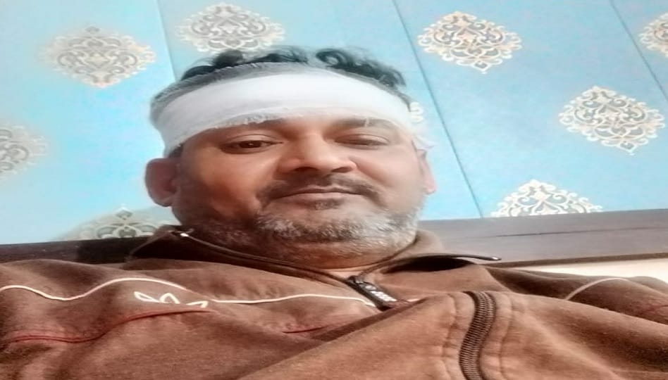 Furniture businessman injured due to breaking of break dance swing trolley at Etawah Mahotsav