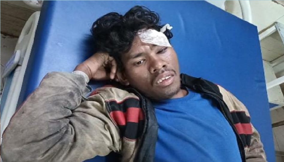 young man attacked with stick and injured three people on charges of mobile theft in Korba