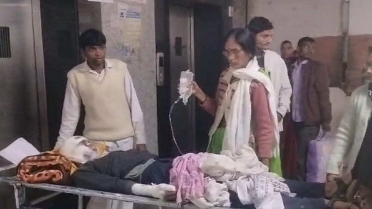 Chhindwara News Innocent child burst rope bomb in his hand hand and face injured