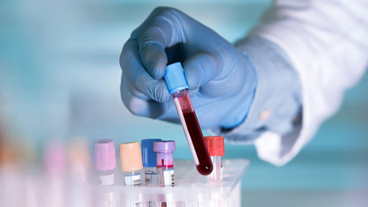 SRN Hospital: Delay in cancer investigation is taking a toll on the patients suffering from pain