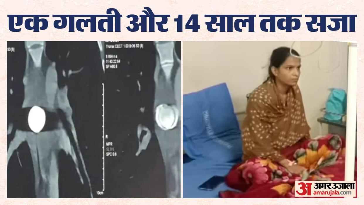 MP News One rupee coin stuck in girl neck for 13 years operation successful