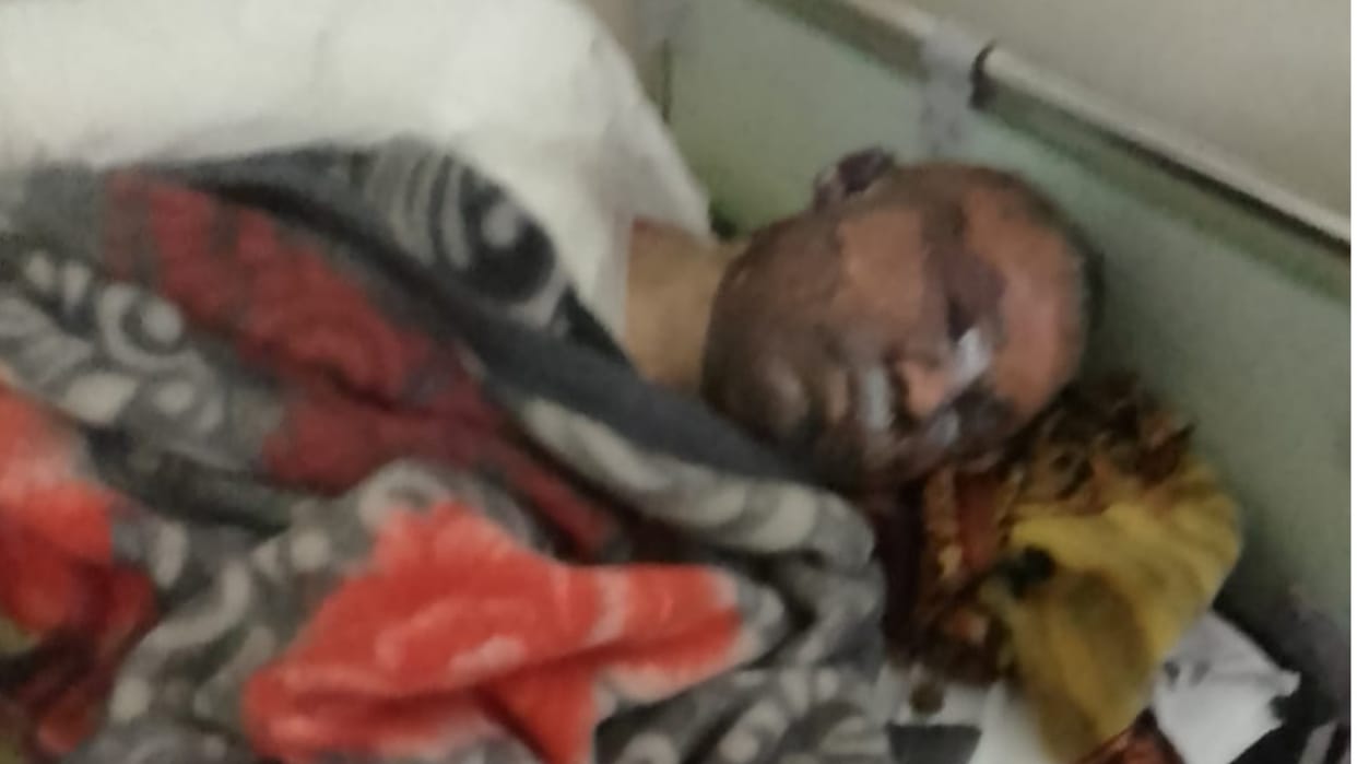 Narnaul: Due to quarrel with wife, husband was poured petrol and set on fire, death