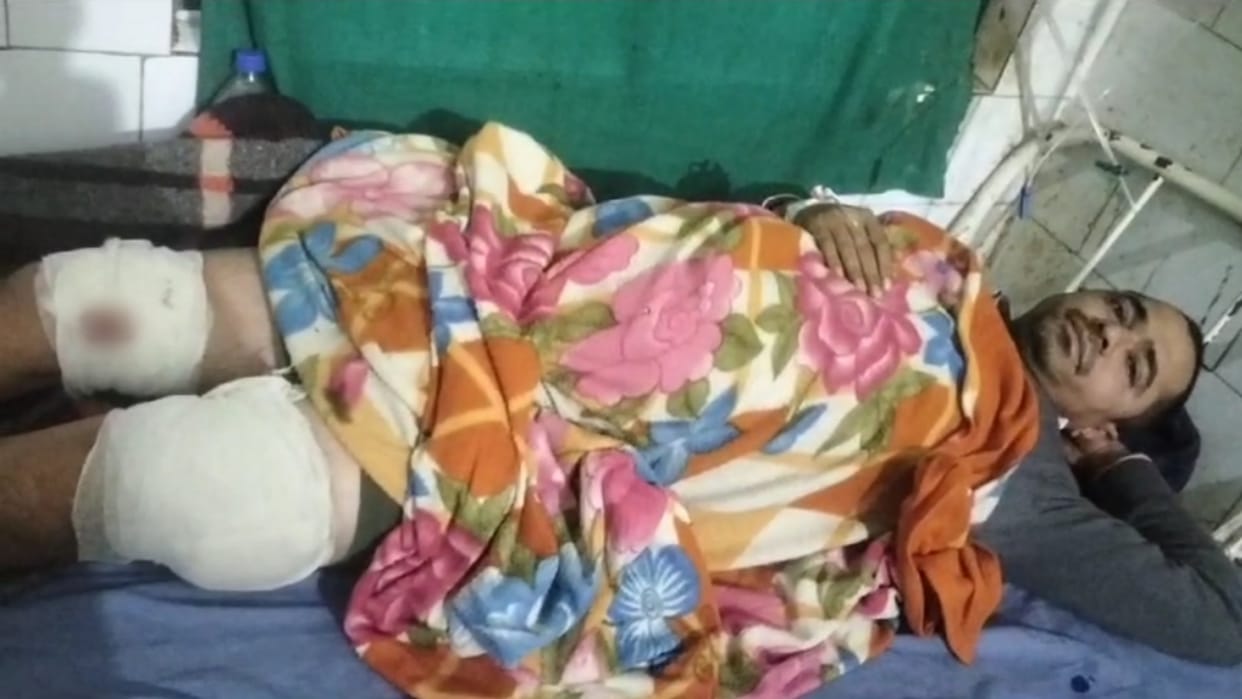 Darbhanga: Miscreants looted Rs 10 lakh after shooting petrol pump owner's son; Injured admitted to hospital