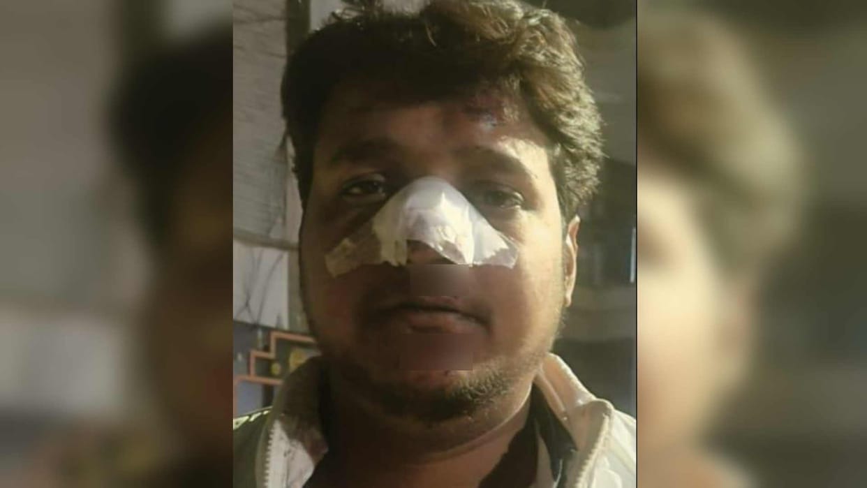 Car collides with bike drug dealer beaten for protesting