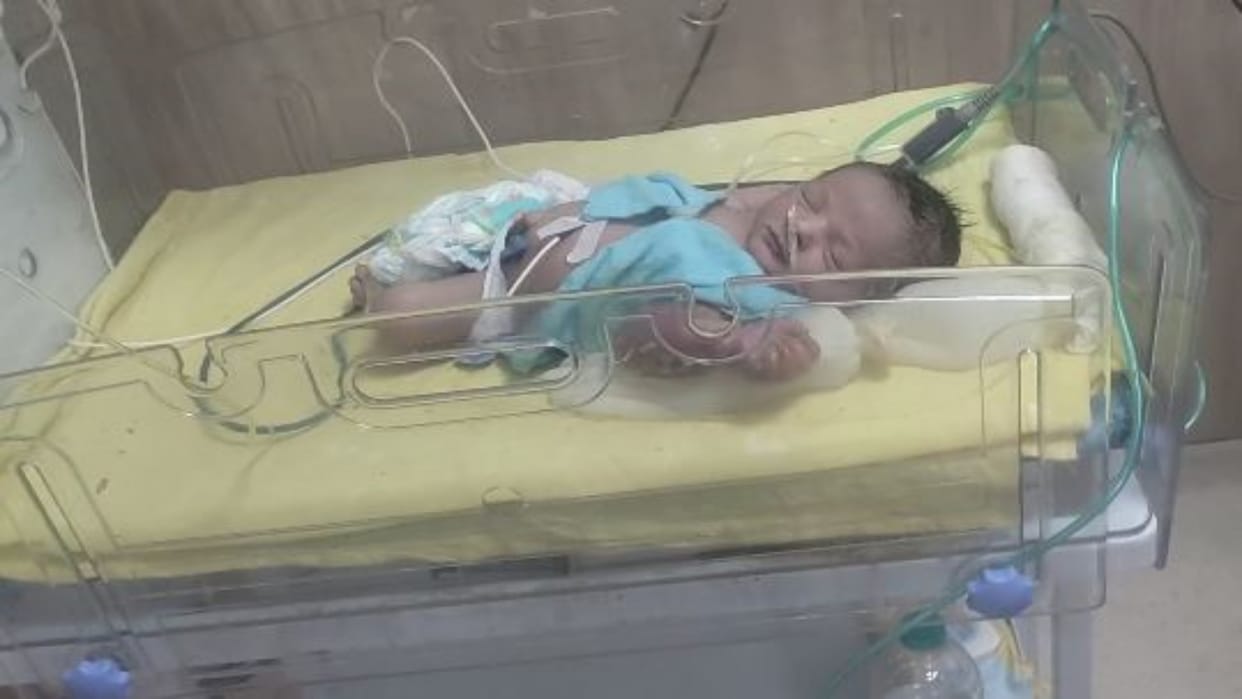 Rajasthan News: Newborn's hands and mouth burnt due to negligence, heater was installed to protect from cold