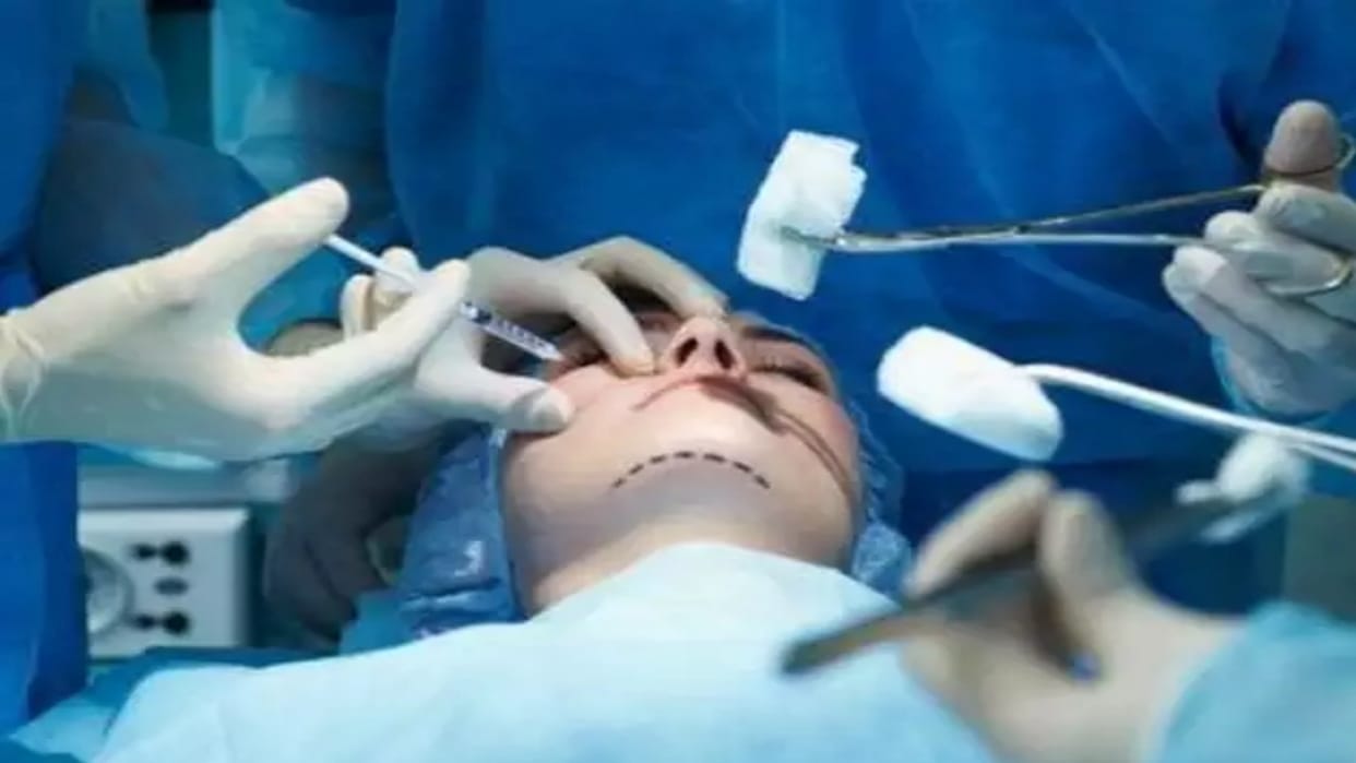 Plastic Surgery: Girls are undergoing surgery to beautify their faces