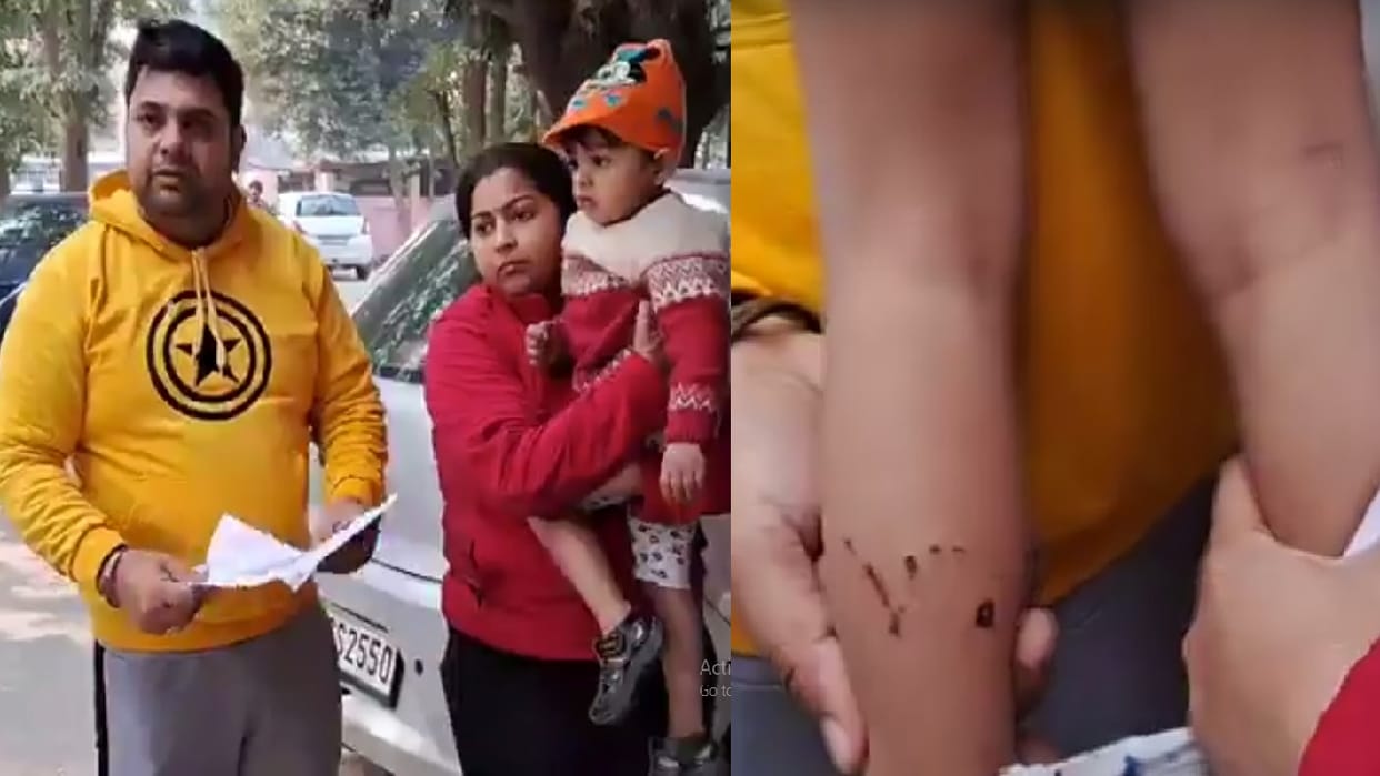 Viral Video Dogs attack two and a half year old child in Ghaziabad
