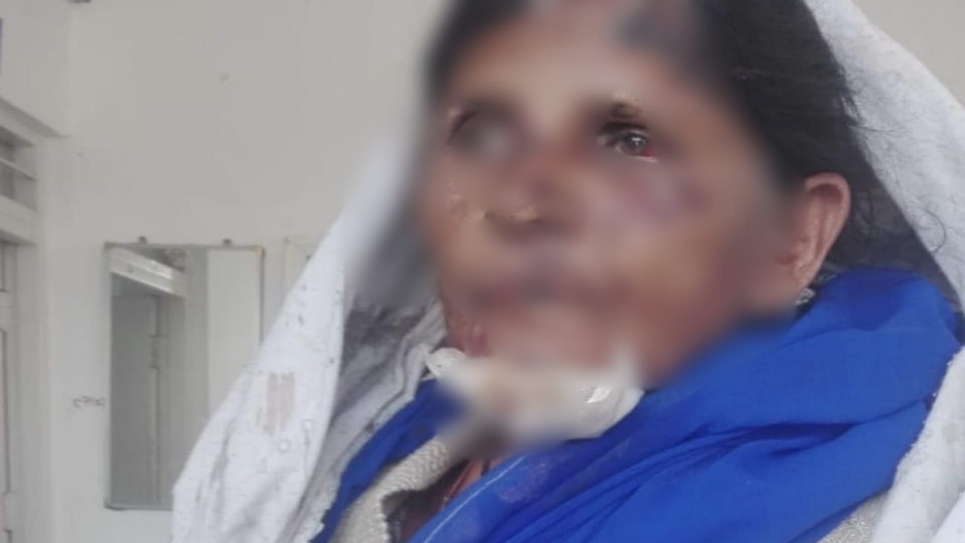 घायल महिला