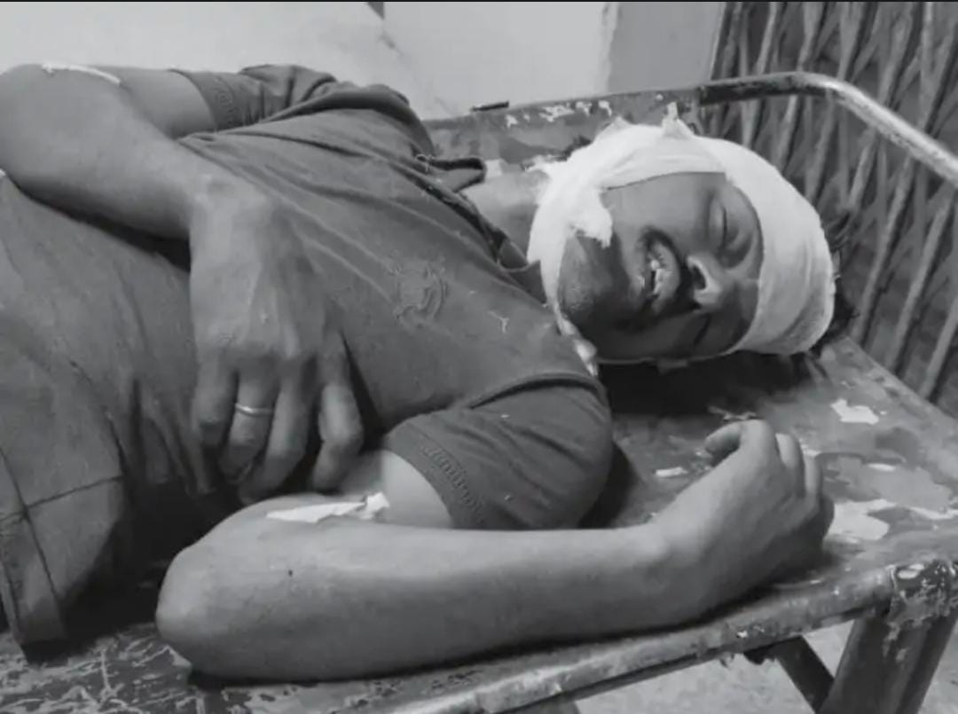 Indore News: In Indore, a young man was murdered due to illicit relations, he was hit on the head with a rod.