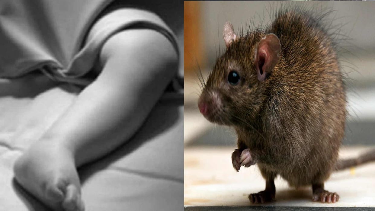 Rats ate one eye of an innocent child body