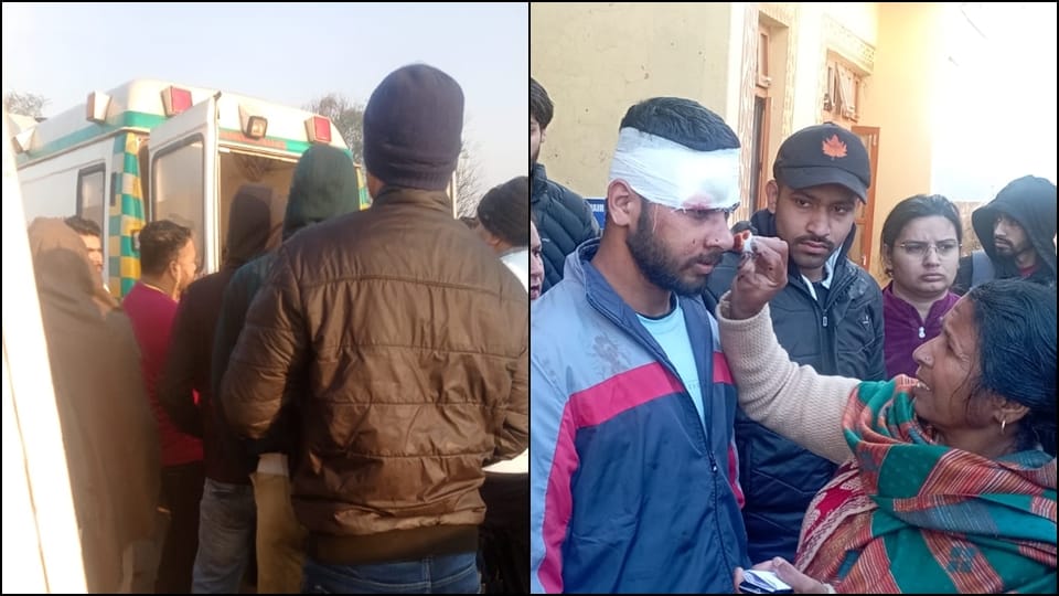 Jammu Accident: Bus coming from Arnia to Jammu overturned 17 passengers injured seven referred to GMC