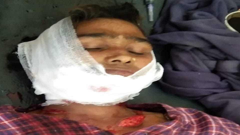 Uttarakhand News: Leopard attack woman who went to forest to collect wood in khatima
