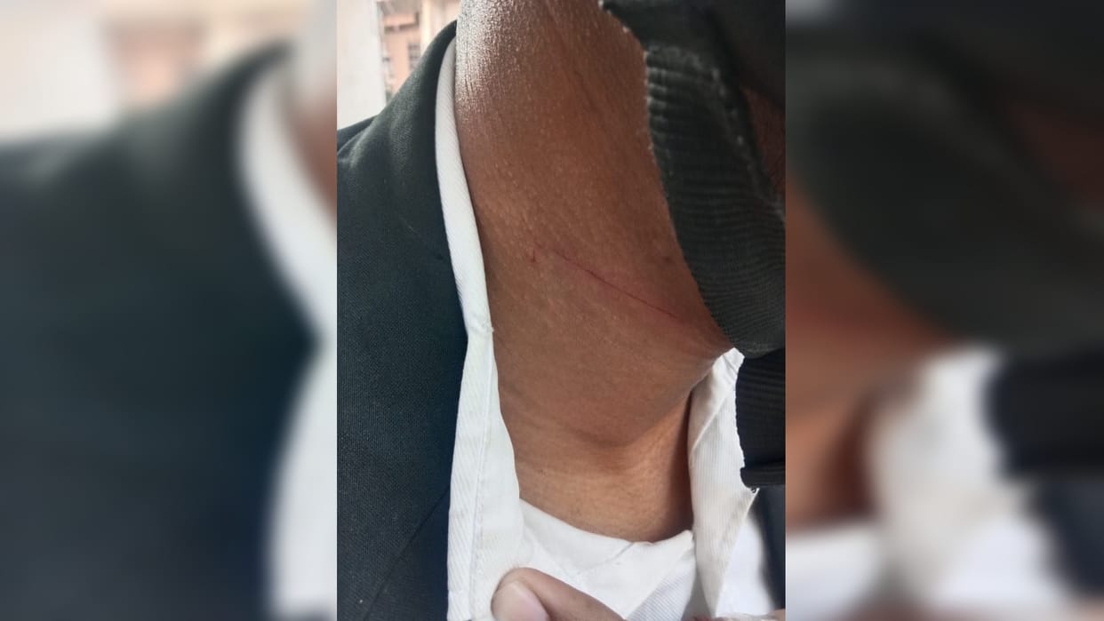 Advocate's thumb cut by Chinese mortar on new bridge, neck also bloody