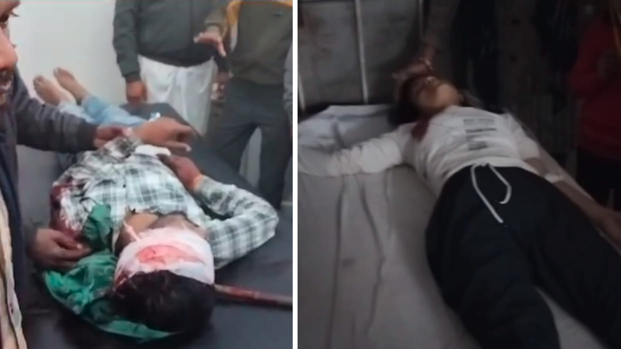 Panchnama of love: Girlfriend rejected marriage proposal, boyfriend entered the house and shot her
