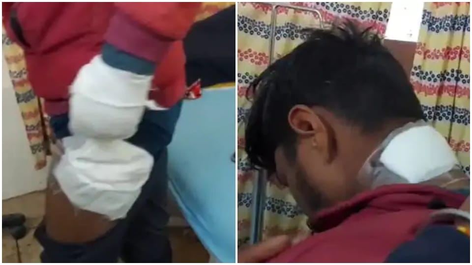 Ujjain News: Cruelty in Badnagar young man genitals burnt with hot rod