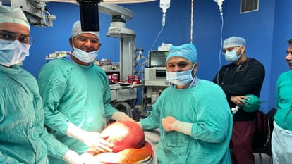 एसआरएन अस्पताल में महिला के पेट से निकला ट्यूमर।