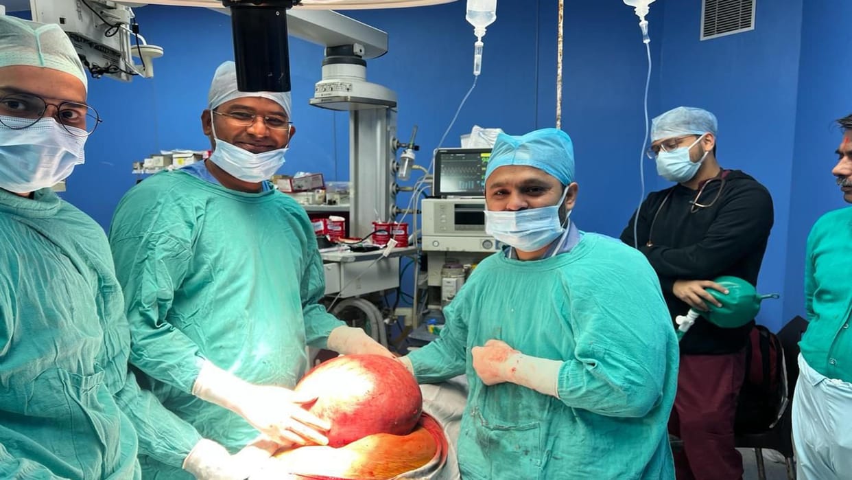 17 kg tumor removed from woman's stomach in SRN Hospital, even doctors were surprised