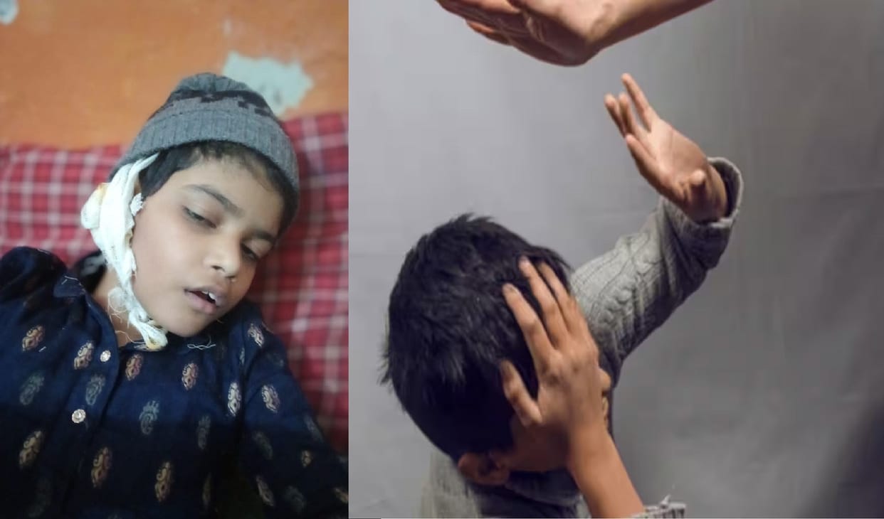 Teacher turned beast, Class 5 student beaten for not doing homework, slapped 8-10, blood came out of ear, admi