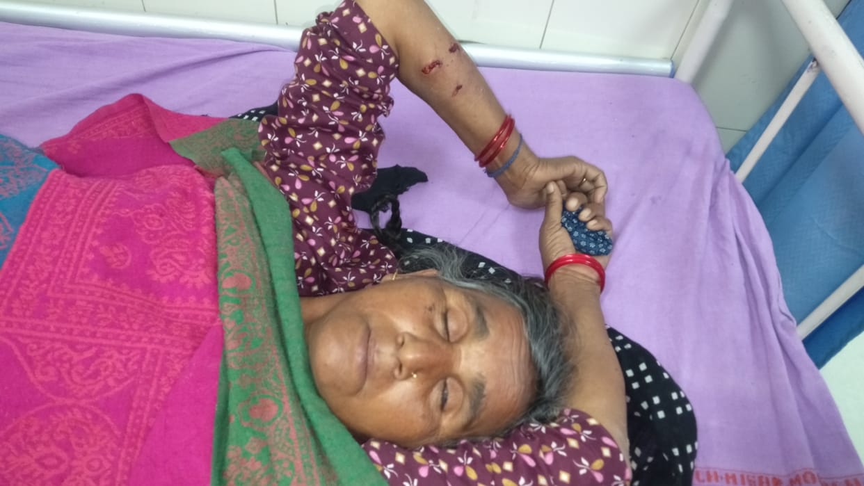 Hisar: Three dogs scratched a woman in the street, neighbors rescued her