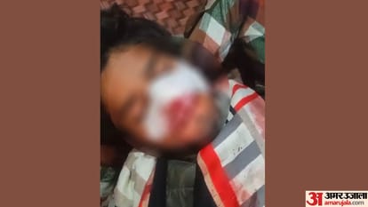 Bullies shot a young man in nose when he asked for money In Prayagraj