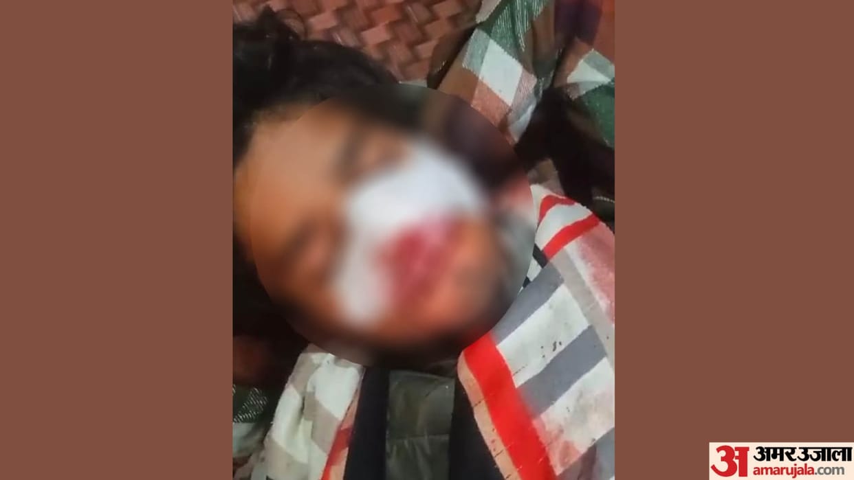 Bullies shot a young man in nose when he asked for money In Prayagraj