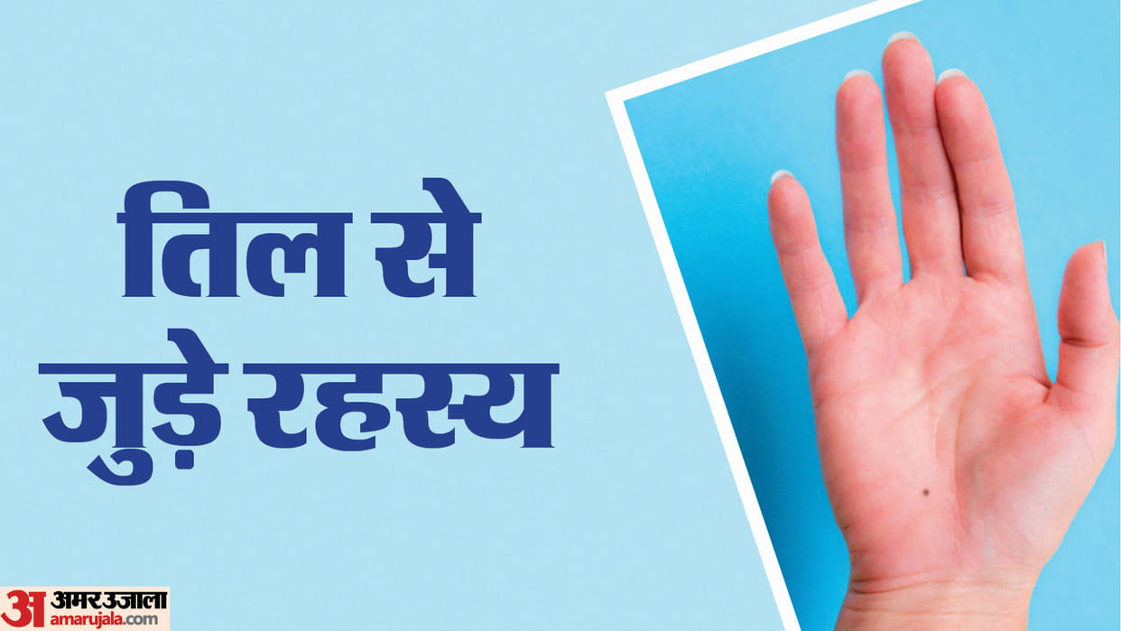 Mole on Palm What does a Mole on your Palm signify in hindi