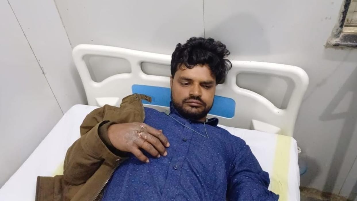 Young man who climbed on top of DJ gets electrocuted