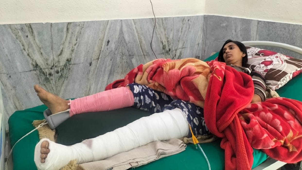 Group of monkeys attacked in Fatehabad, Woman jumped from roof to save her life, both legs broken